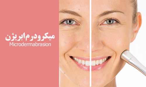 قیمت دستگاه میکرودرمی ابریژن